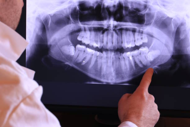 Best Weekend Emergency Dentist in Salmon Creek, WA