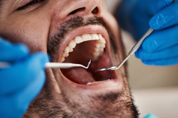 Best Pediatric Emergency Dentist in Salmon Creek, WA